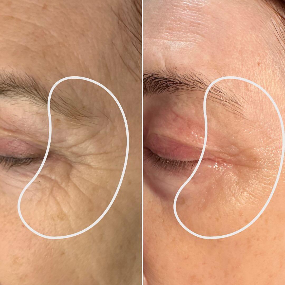 Golden Face™ Forever Young Serum